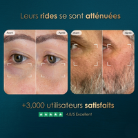Eyepulse by Lamyacare